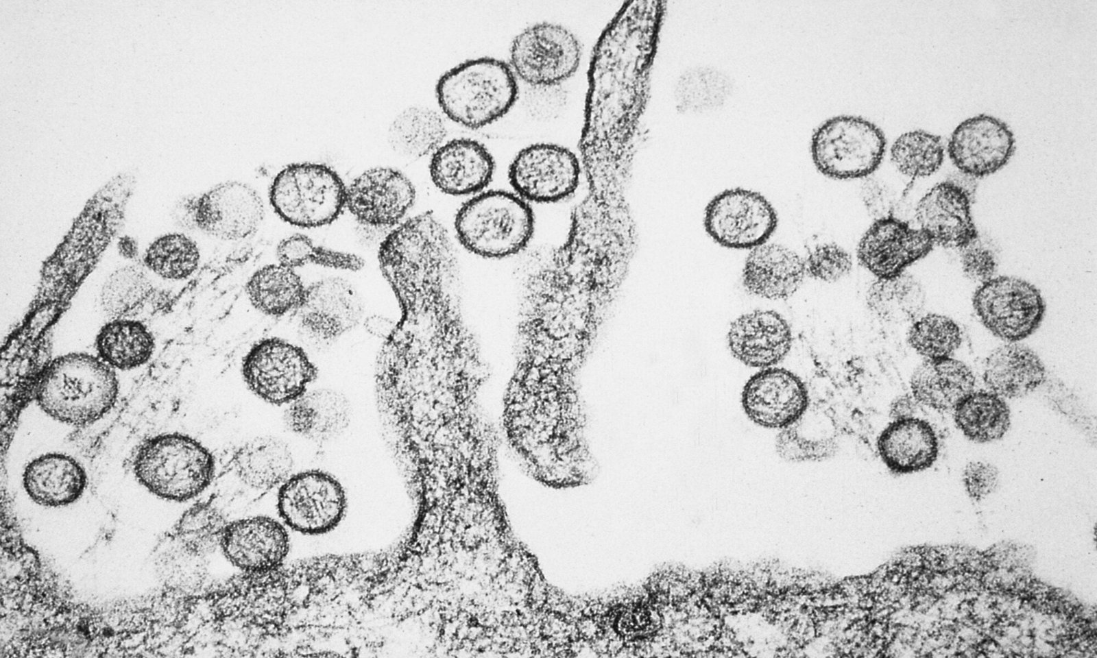 Sin Nombre hanta virus TEM PHIL 1136 lores