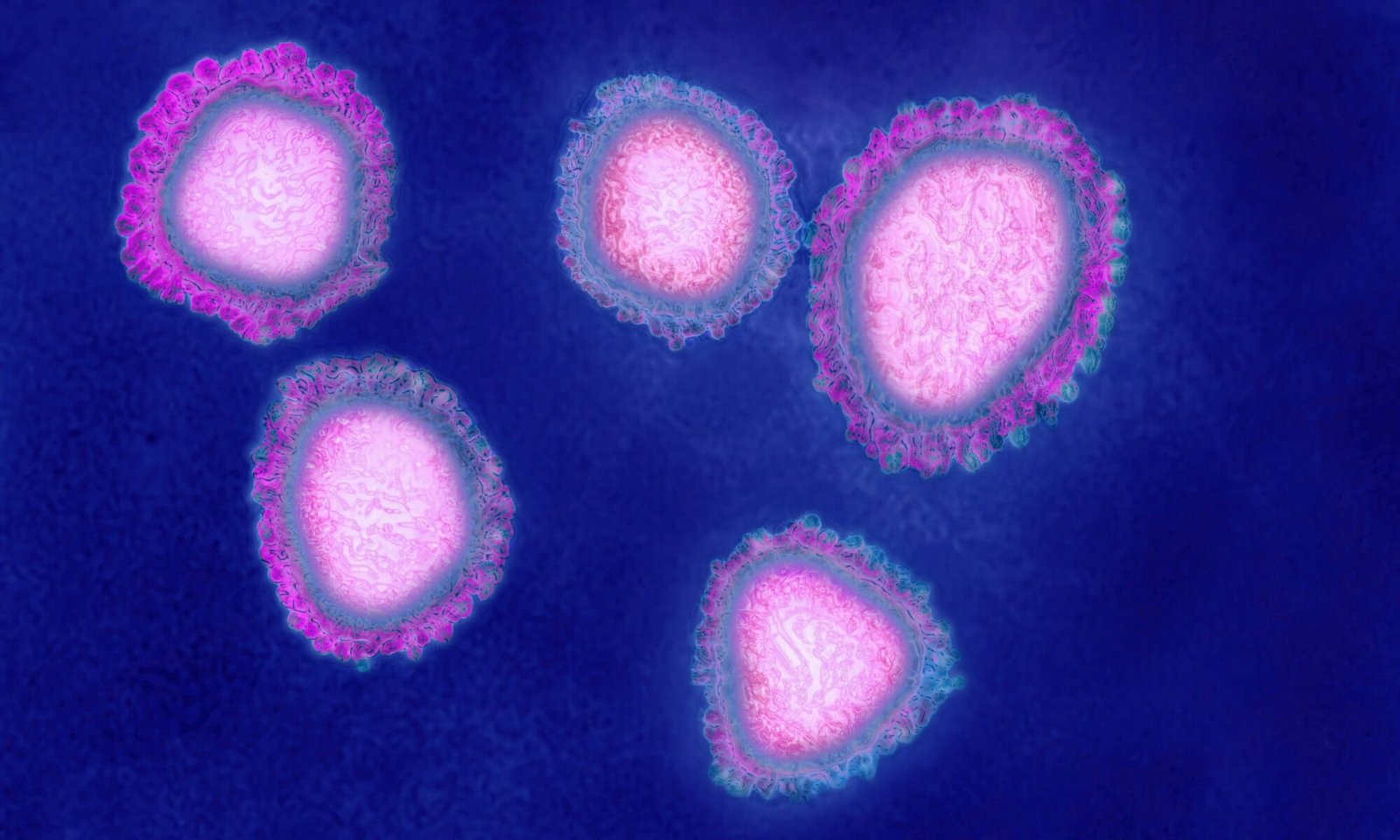 The human coronavirus causes respiratory infections and news photo