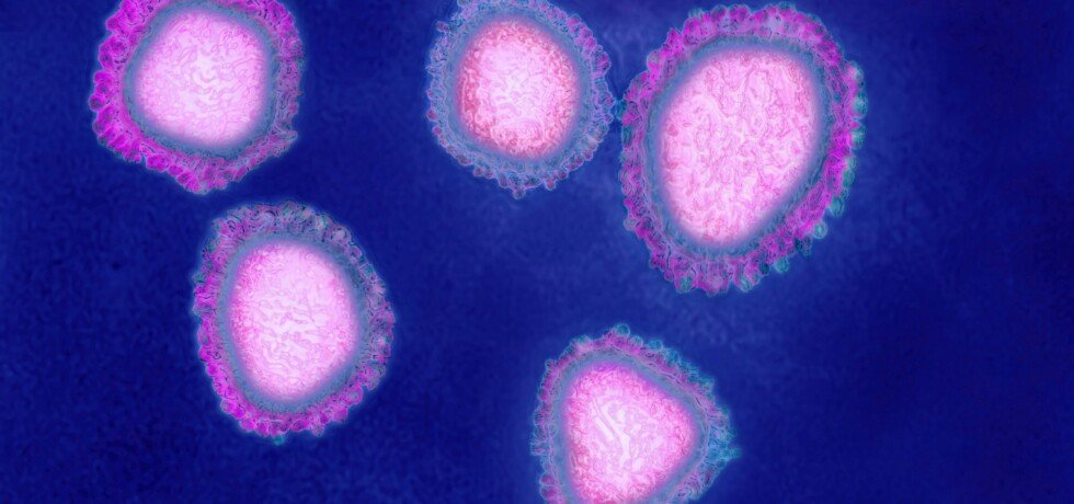 The human coronavirus causes respiratory infections and news photo