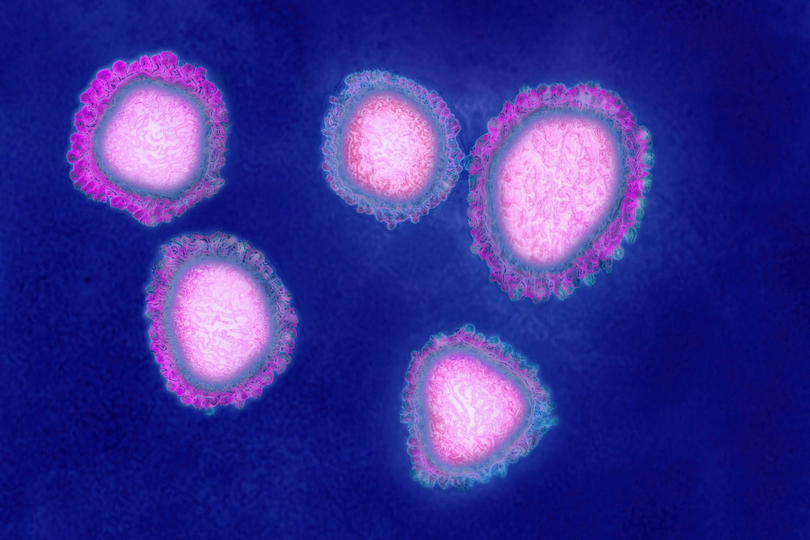 The human coronavirus causes respiratory infections and news photo 1579721884